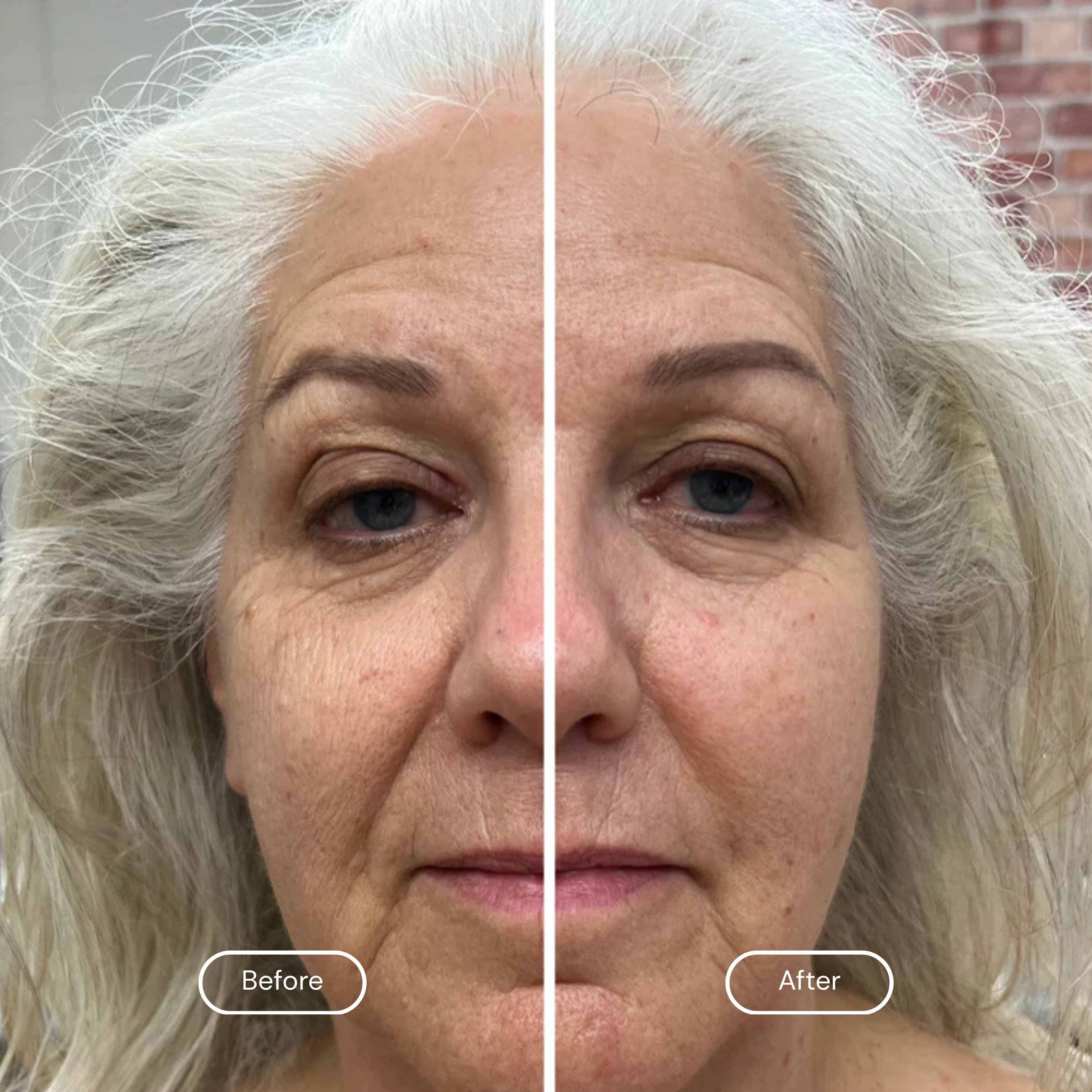 Face Lymphatic Contour Brush