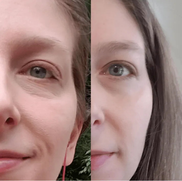 Lejuv Beauty Patches