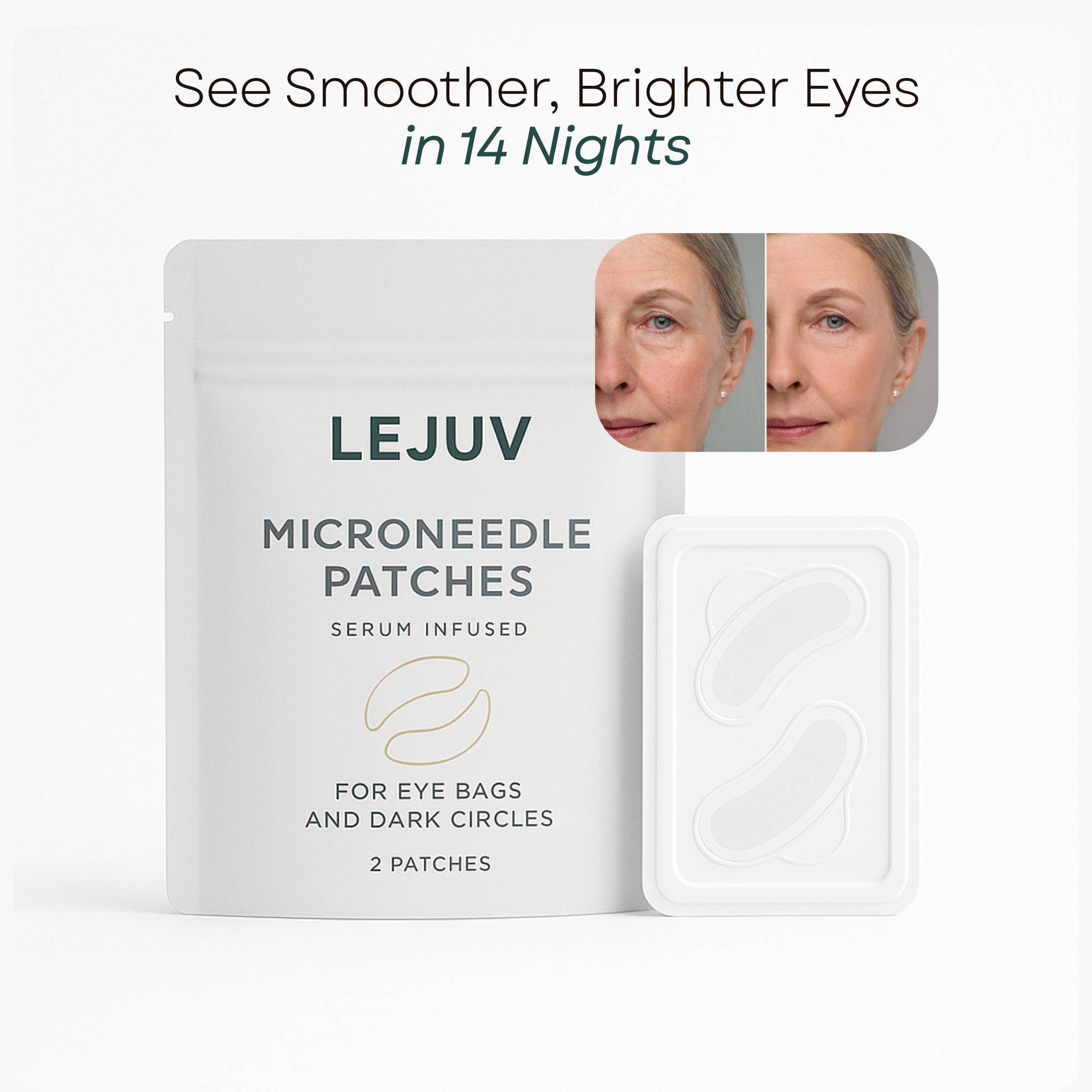 Hyaluronic Microneedle Patches