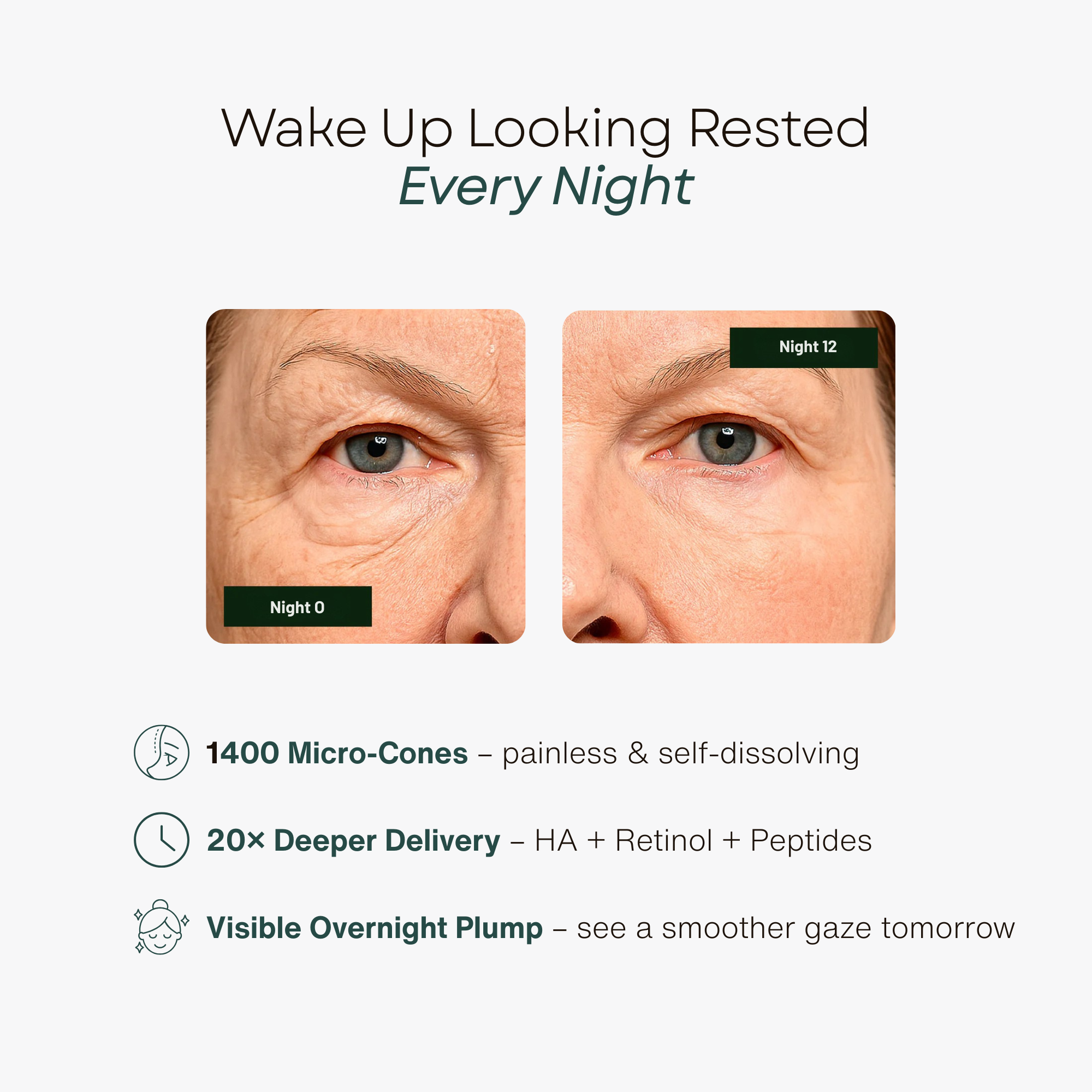 Hyaluronic Microneedle Patches