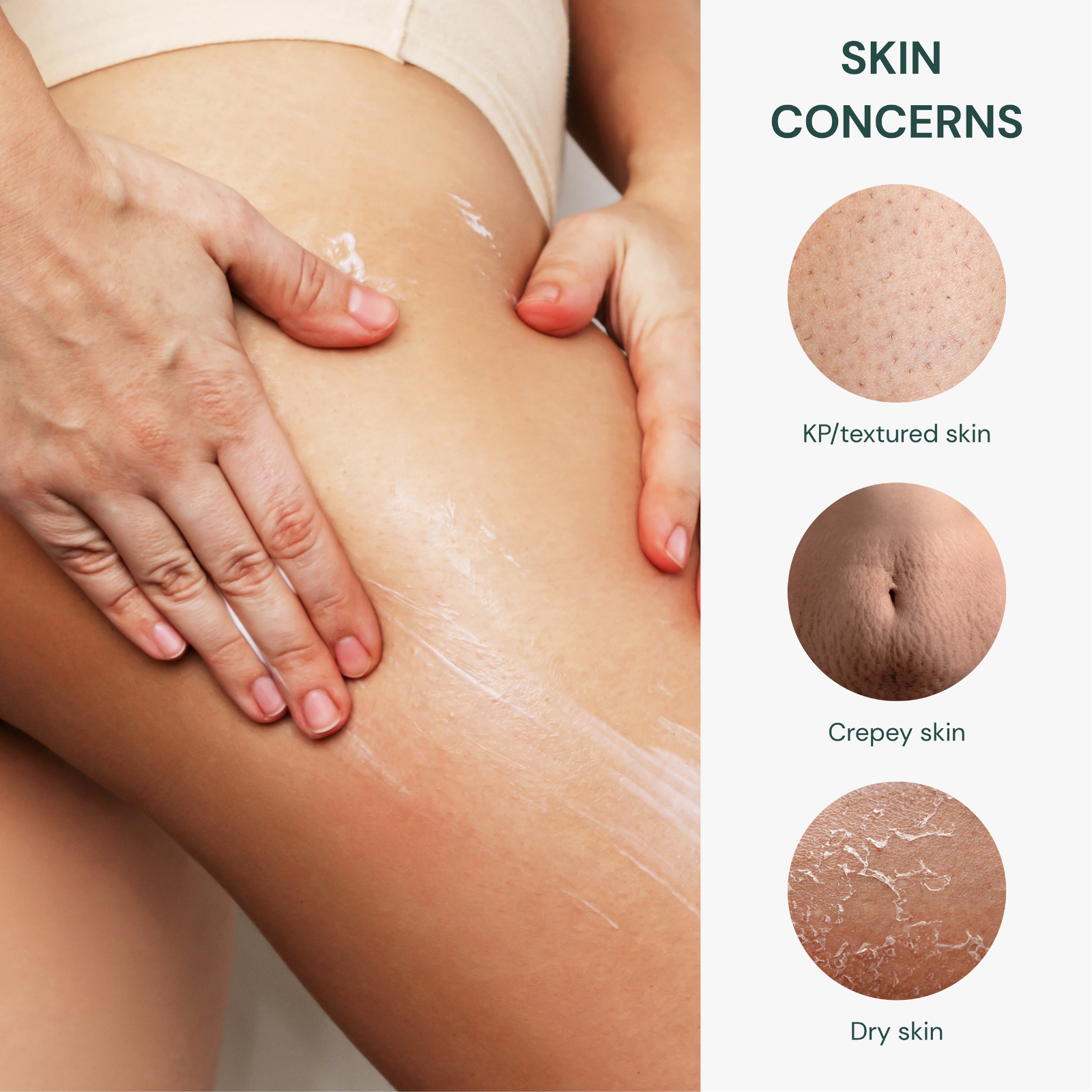 Lejuv for Body Bumps