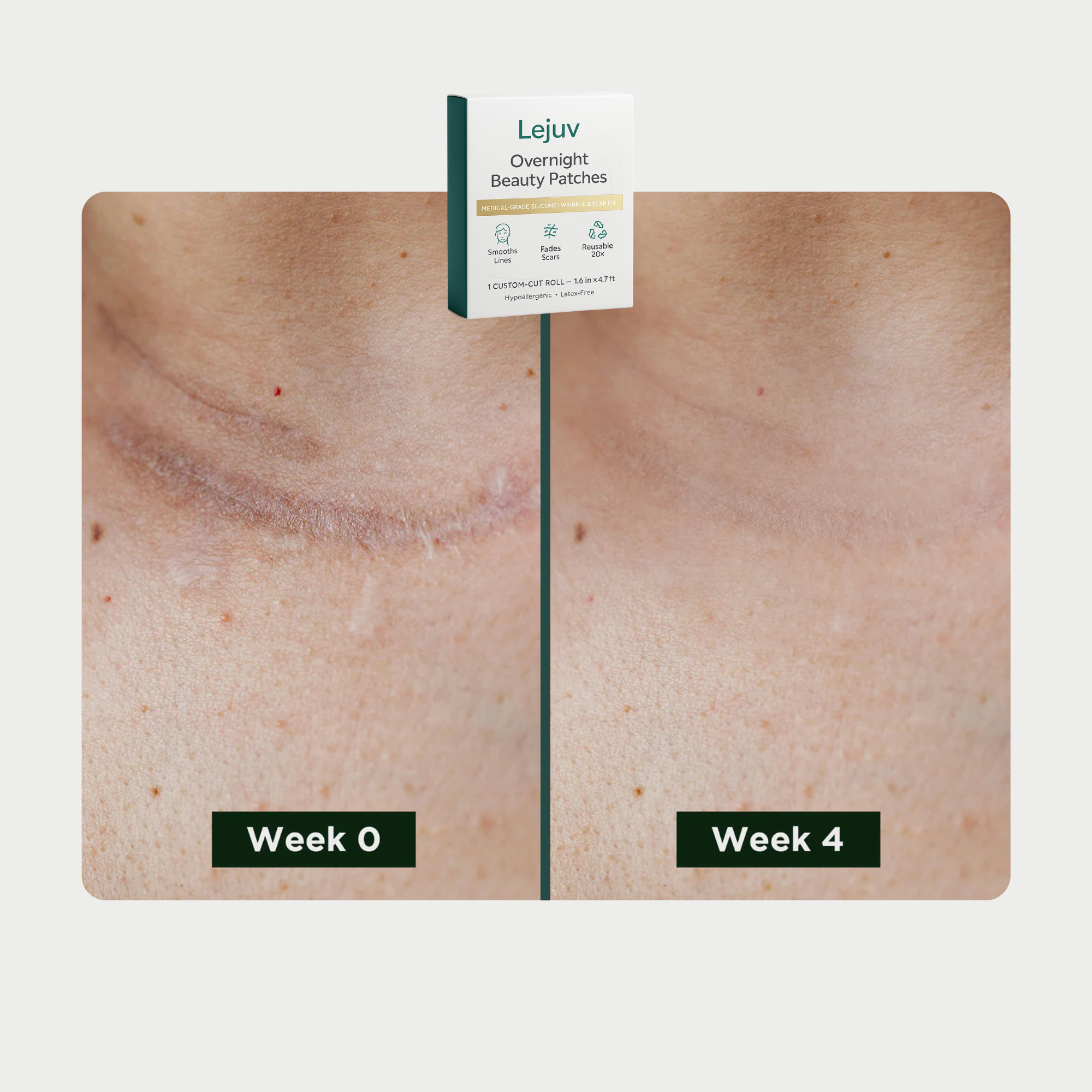 Beauty Patches