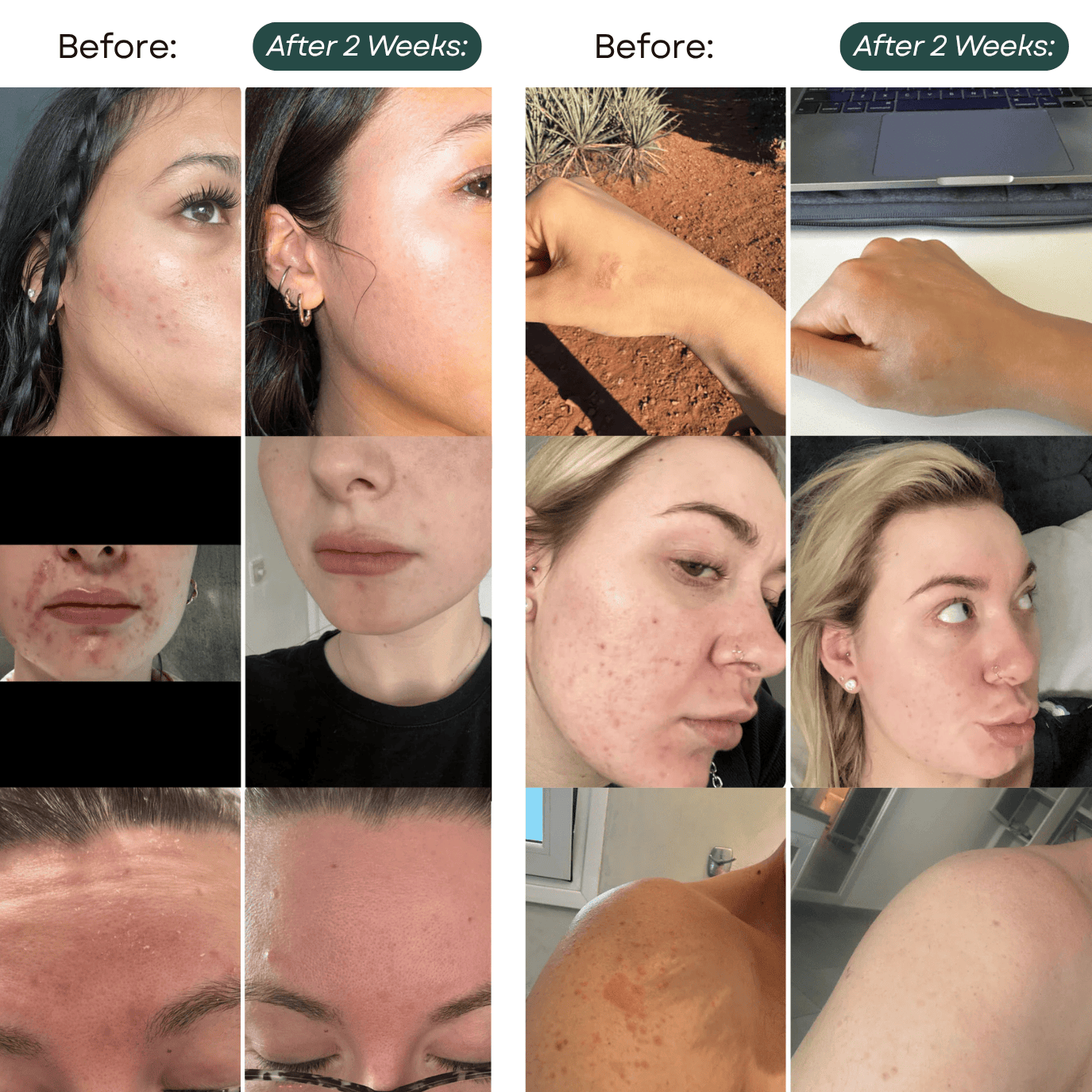 Lejuv™ Skin-Food Balm